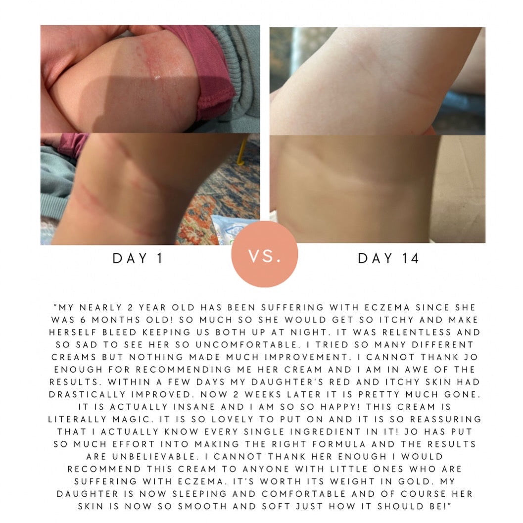 Bloom Skin Baby & Child Balm