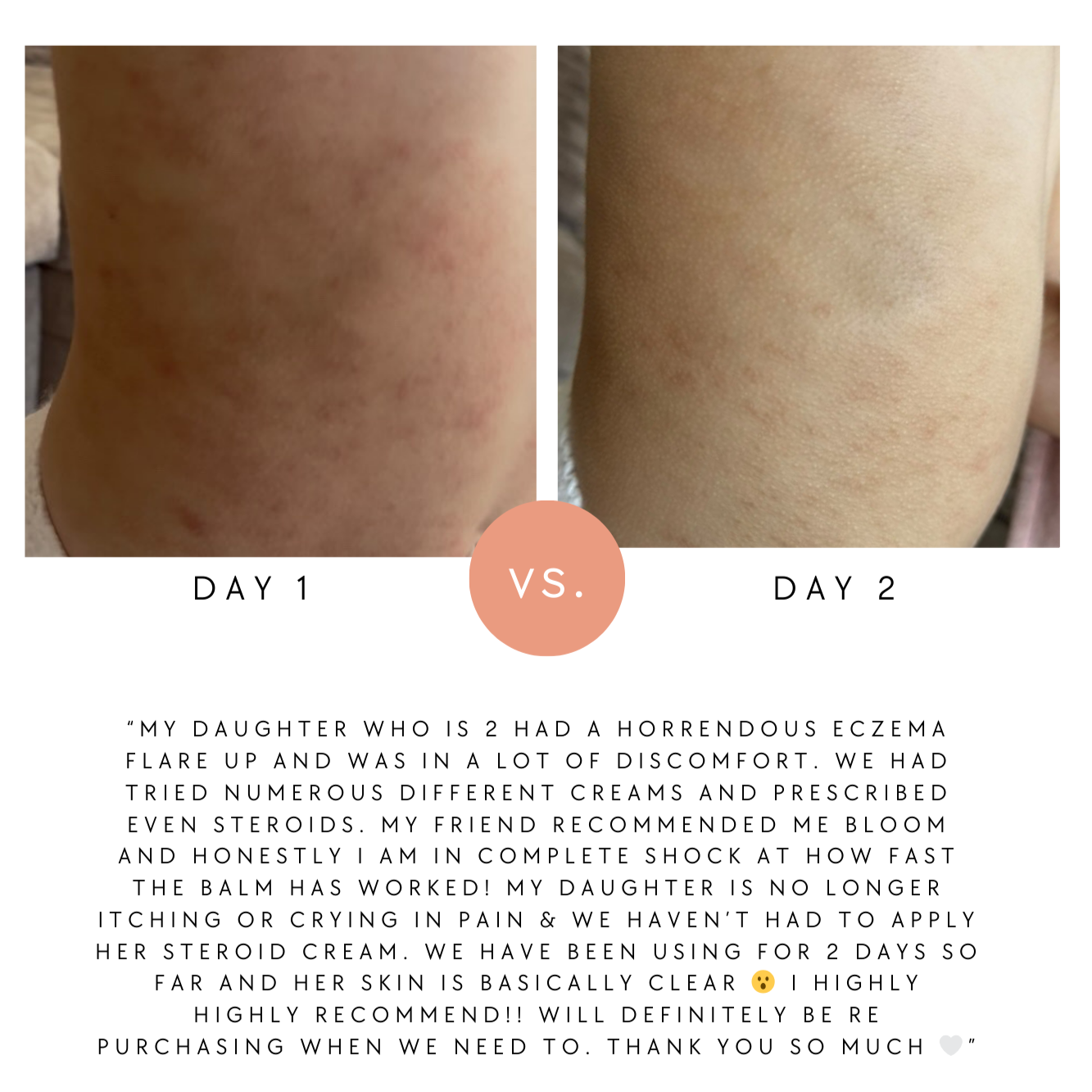 Bloom Skin Baby & Child Balm